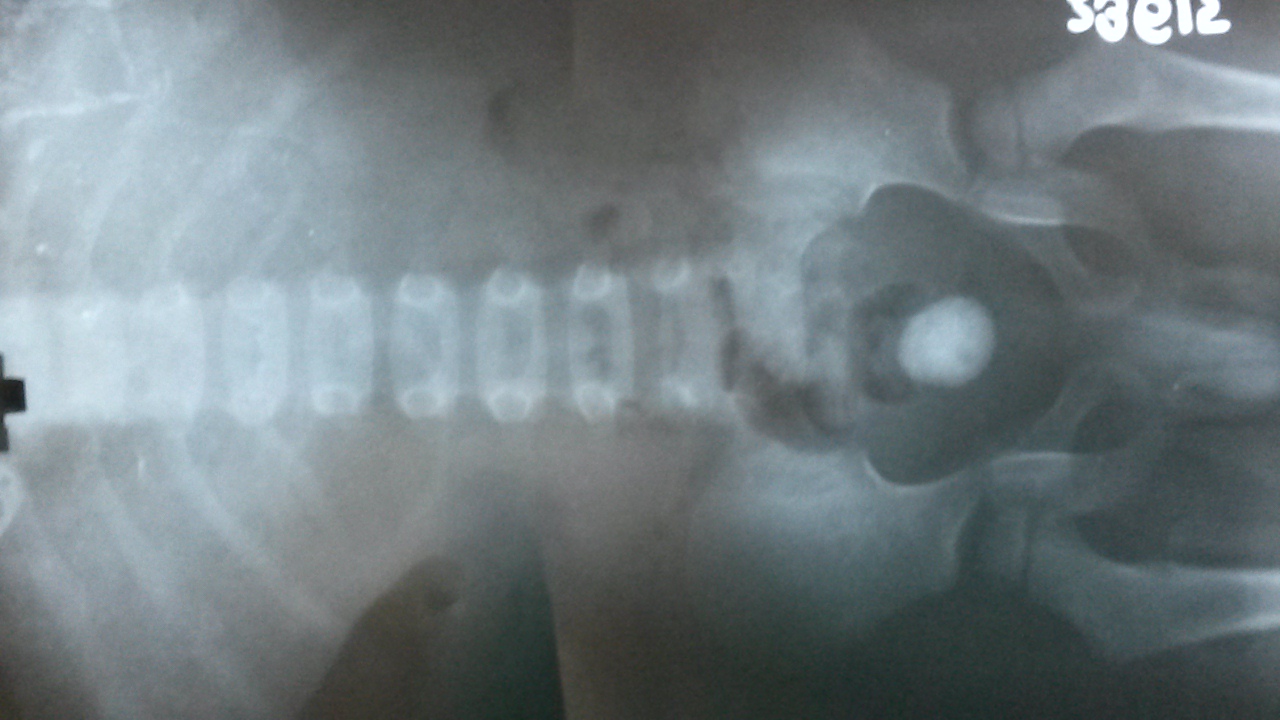Pediatric Urology Image 6